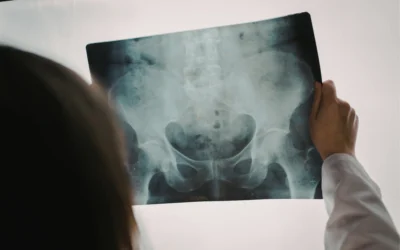 Pelvic Floor Physical Therapy for Men