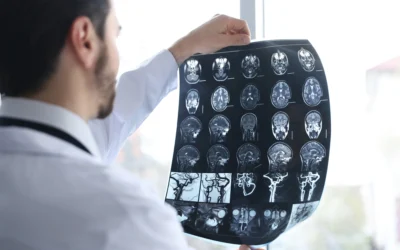 Physical Therapy for Brain Injury