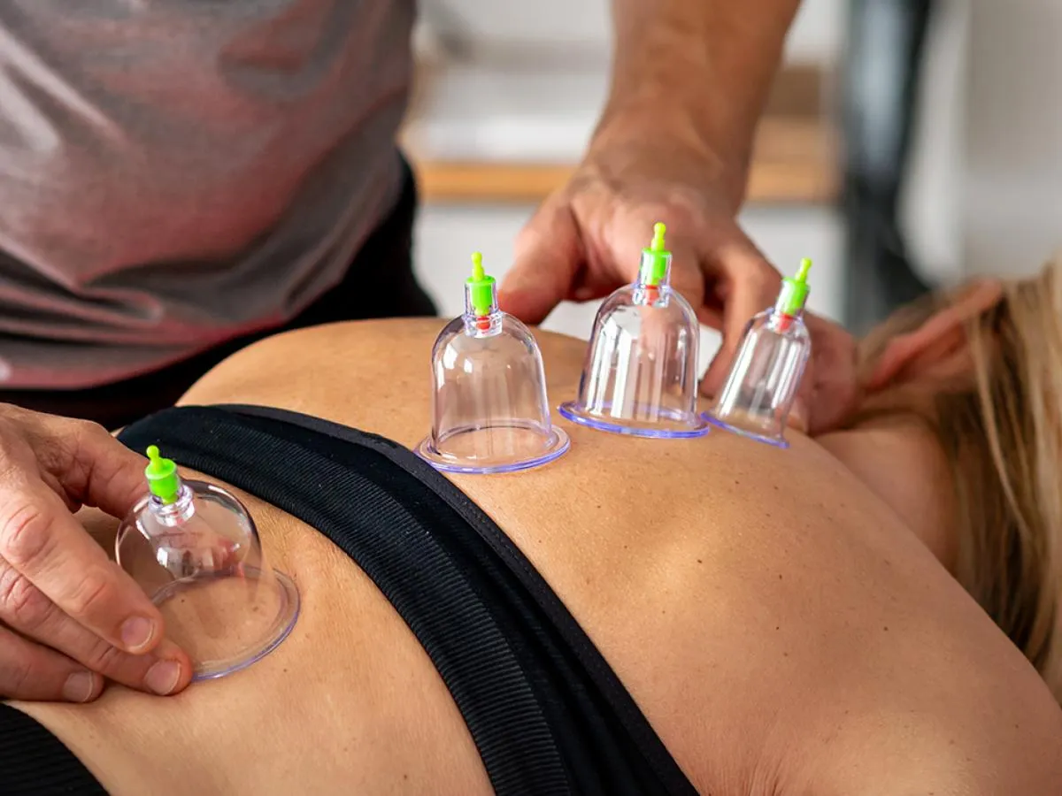 Cupping Therapy